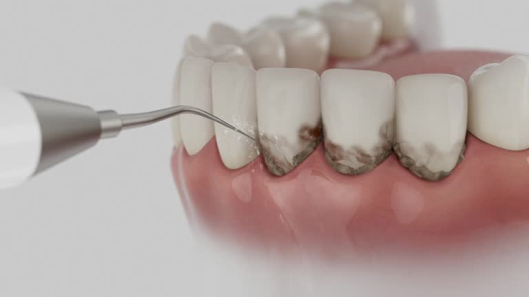 Trusted Wisdom Tooth Removal service in Malmstrom AFB, MT - Dentist Open Now